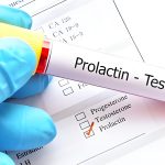 Prolactin and Fertility